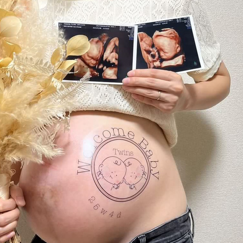 マタニティフォトシール【ツインズ 窓】双子 twins 雑貨・その他 