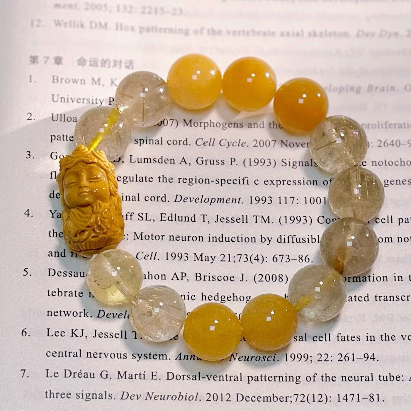 【11号】 熱中と愛を習って他の人から愛情を感じます。 自分を、人より卑しいとか劣っているとか思っている様子をしません。