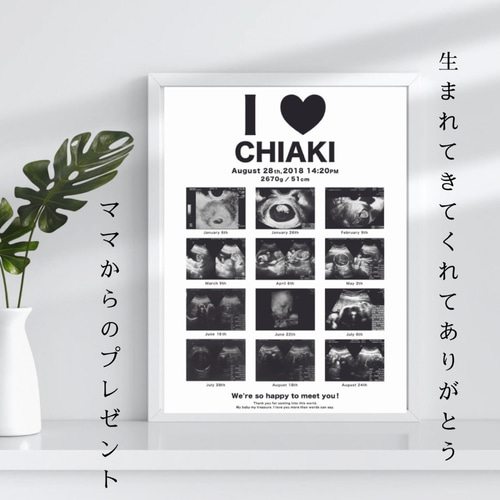White】データ付き エコー写真ポスター／セミオーダー／データのみも 