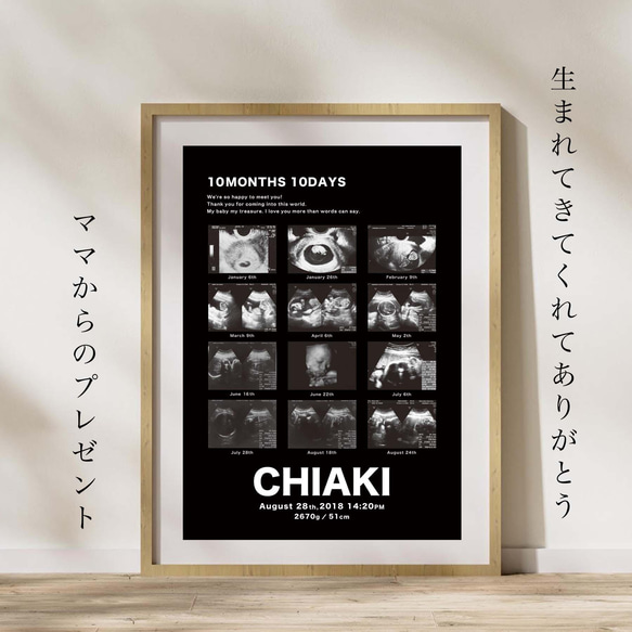 Black】データ付き エコー写真ポスター／セミオーダー／データのみも 