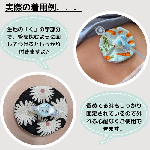 新作入荷！！前作好評ボタン無し胃ろうカバー その他ファッション雑貨