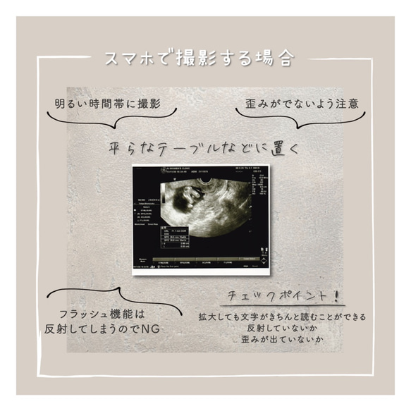 【サプライズ】エコー写真入りアクリルアート【妊娠サプライズ】 3枚目の画像