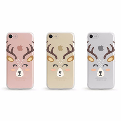 小鹿- 防摔透明軟殼- iPhone 7, iPhone 7 plus, iPhone 6, iPhone SE 第2張的照片