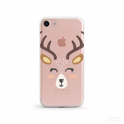 小鹿- 防摔透明軟殼- iPhone 7, iPhone 7 plus, iPhone 6, iPhone SE 第4張的照片