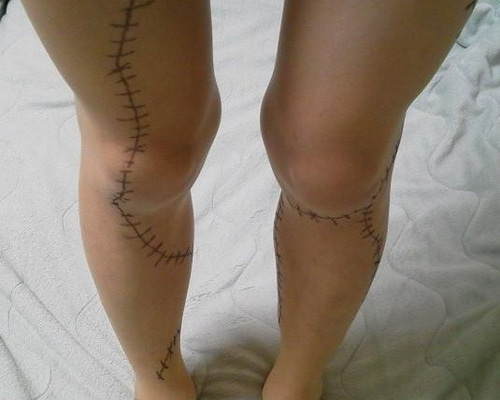 タトゥータイツ ナイトメアビフォアクリスマス サリーの足ストッキング