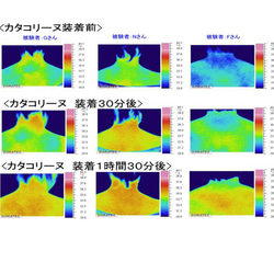 肩こりの方必見！とんぼ玉の磁気ネックレス 3枚目の画像