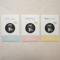 サプライズ！おめでた報告/エコー写真フレーム  妊娠報告  メッセージカード 3枚目の画像