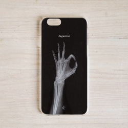 X-ray Phone Case-I&#39;m OK Radiologist iPhone/Samsung/HTC/Sony/ 2枚目の画像