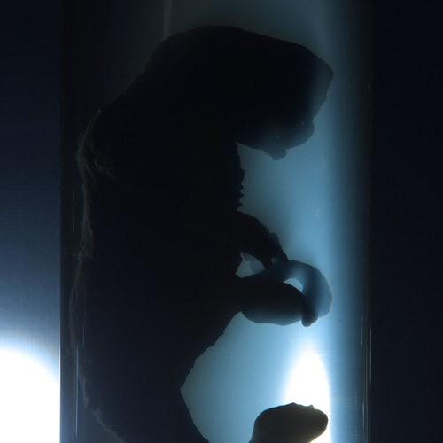 液浸標本: [ヒト型海棲生物の胎児] 立体・オブジェ RottenRoddam 通販