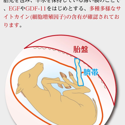 レジュベナ レベナウィズ その他インテリア雑貨 ﾆｰﾄﾞﾙﾜｰｸ.心美身 通販 ...